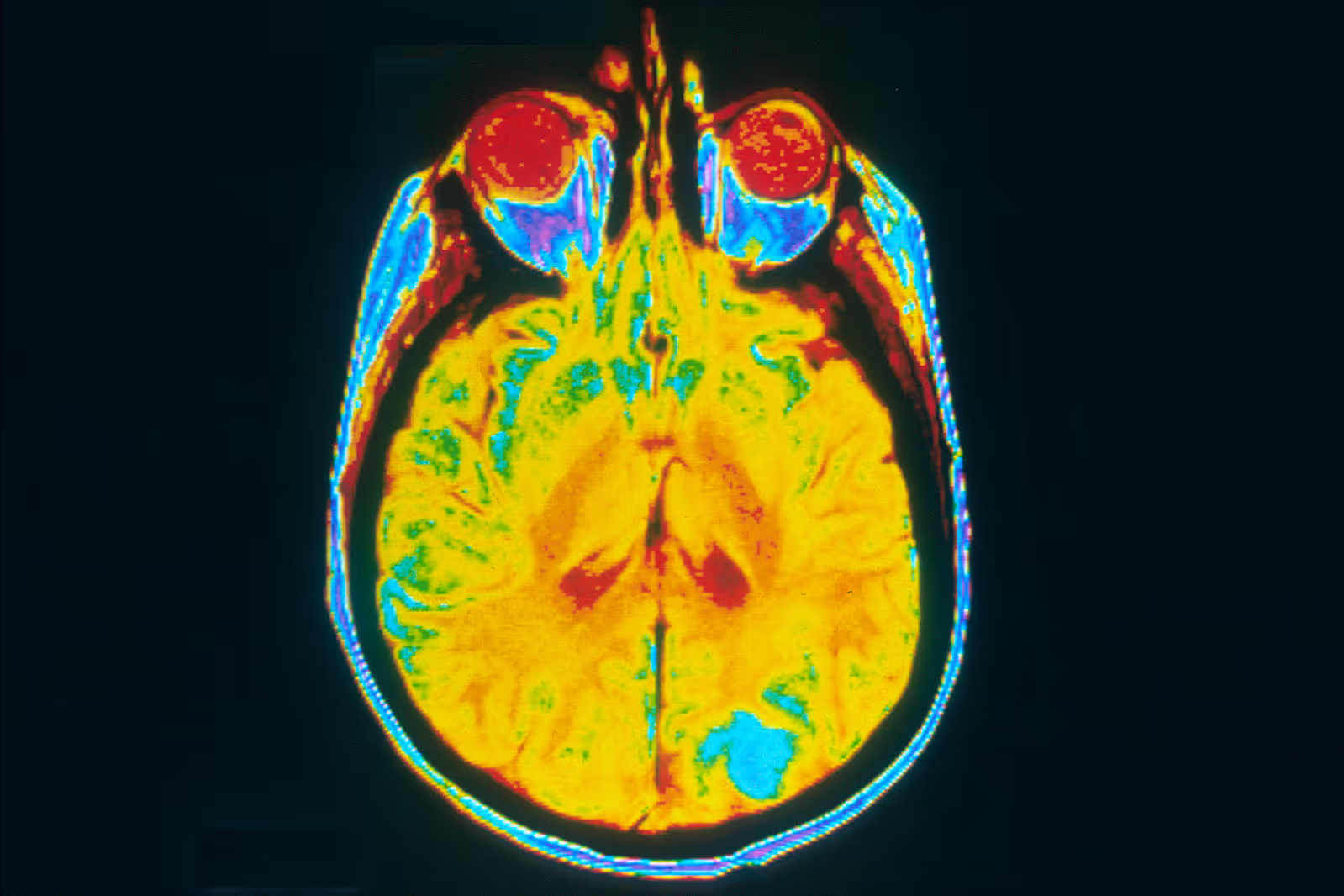 646f8e0d192f0655a879ae1d_MRI