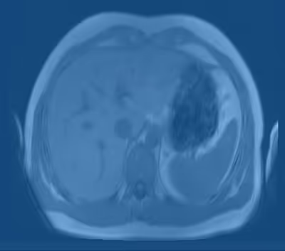 64d511324d6a280348bb0013_Liver4